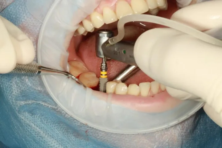 Restorative Dentistry